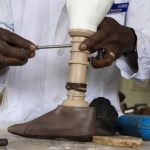 An orthopaedic technology specialist assembles a 3D-printed artificial limb at the Comprehensive Rehabilitation Services Uganda (CORSU) in Wakiso. (Pic: AFP)